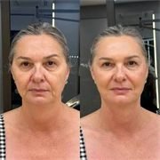 Sarah H. — before and after