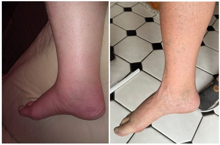 Patricia M. — before and after