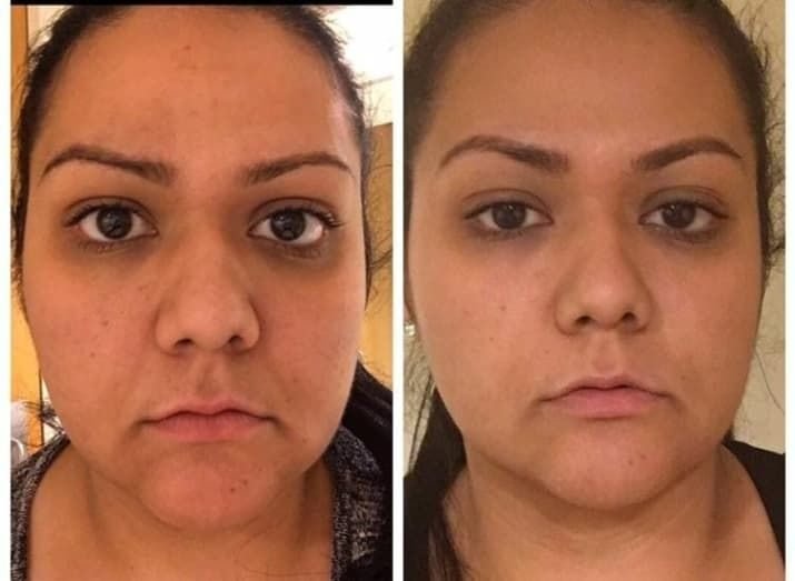 Monica J. — before and after